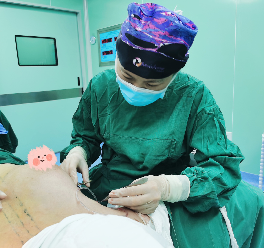 1.吸脂手术属于外科体型雕塑手术中的一种，原理是通过约5mm的小口，借助特制的装置，吸取皮下堆积的脂肪，已达到局部塑形的目的。抽脂不是所有人都可以做。通常来讲，吸脂手术的适宜年龄是18~55岁。