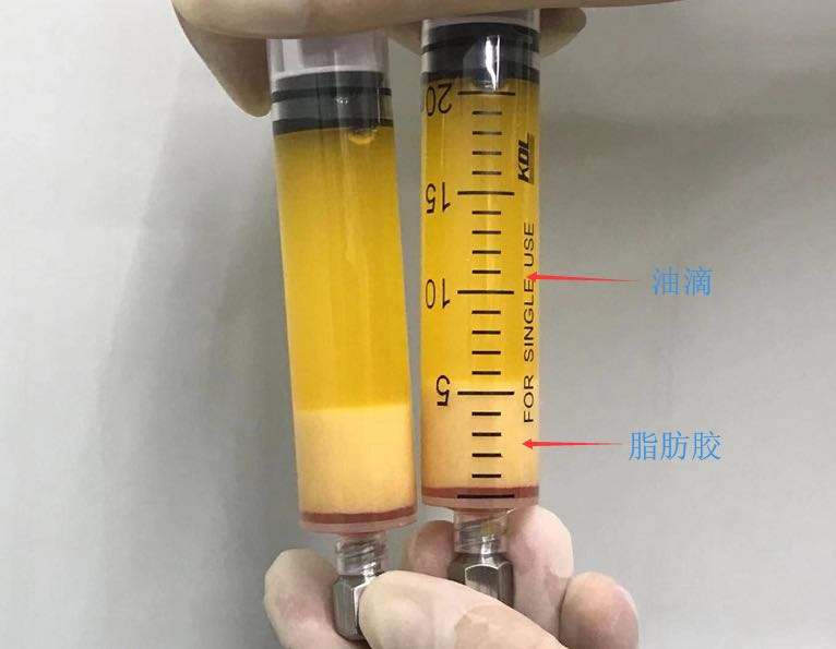 选择自体脂肪填充泪沟，需要经历一个取脂的步骤，这等于加了个手术，取脂部位和填充部位都存在术后恢复期，这是需要你权衡的。