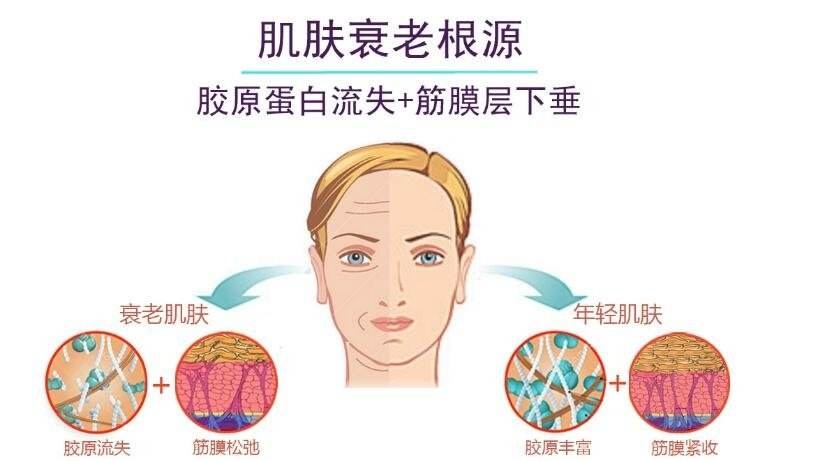 随着年龄增加、新陈代谢缓慢，胶原蛋白流失，造成脸部假性老态提早出现。面部填充，也成为了越来越多求美者的抗衰选择。
