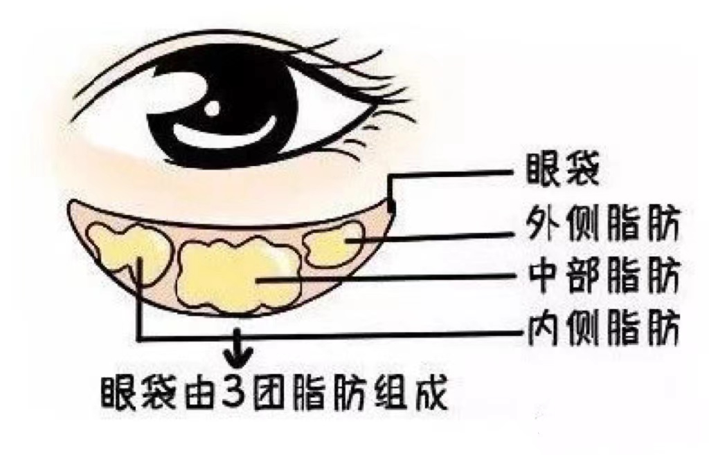 眼袋和卧蚕的区别是什么？