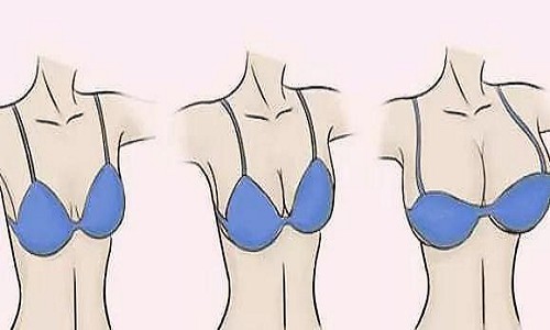 乳房下垂的测试方法？