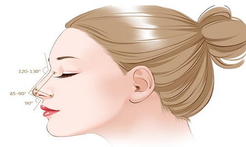 鼻头缩小有哪些类型？