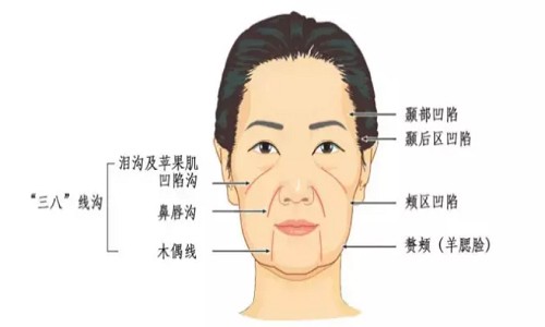 如何改善法令纹