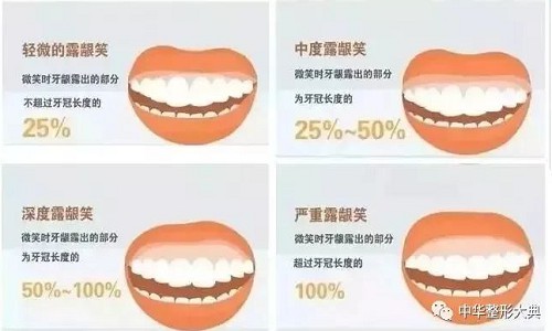 笑的时候露出太多牙龈了怎么改善？